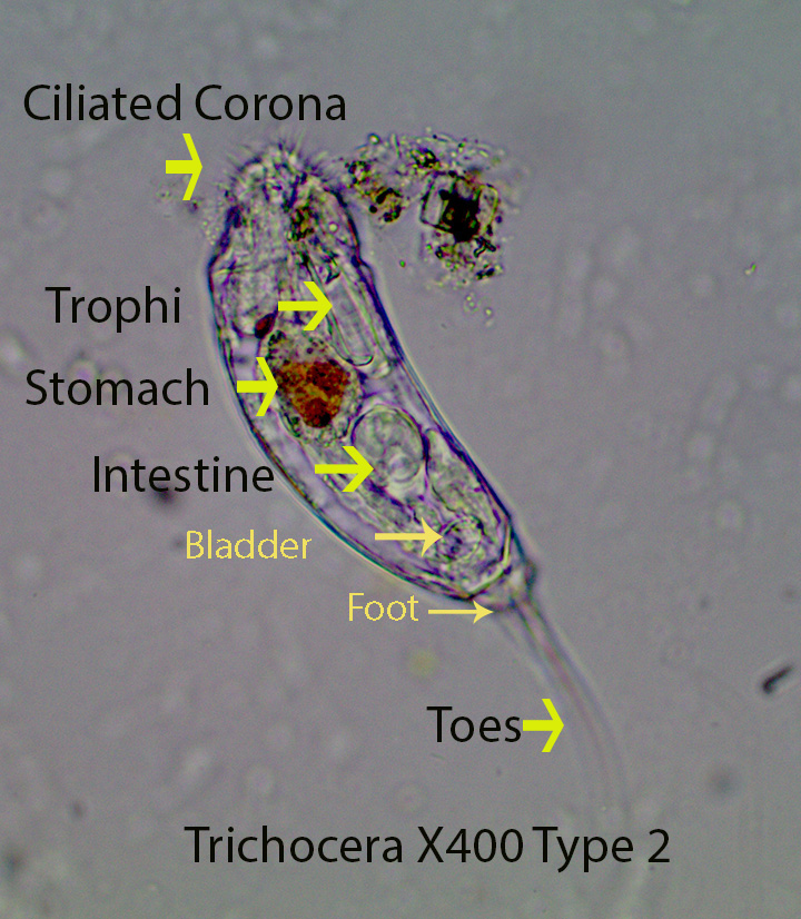 rotifer-trichocera-spp